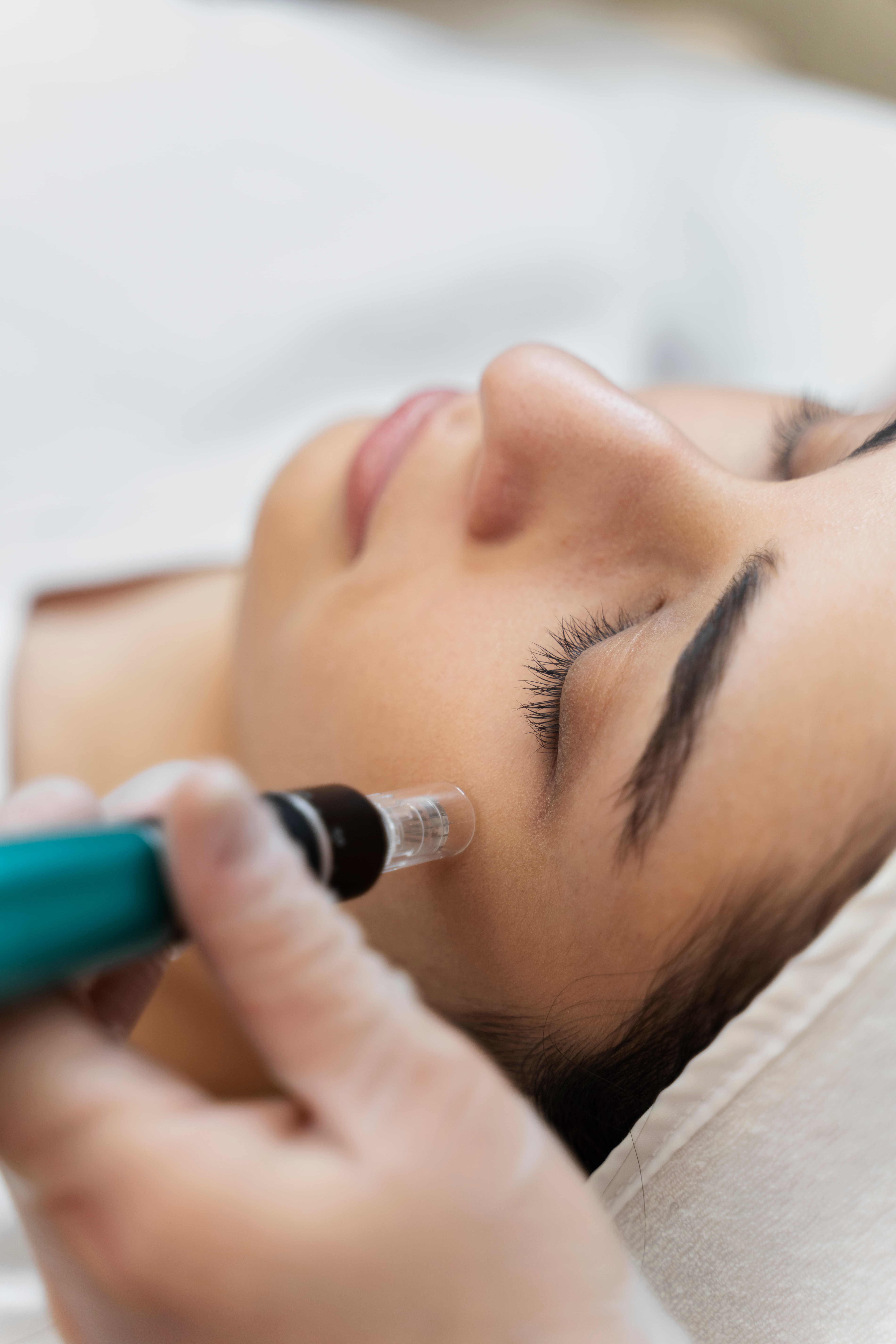 MICRONEEDLING_NAME